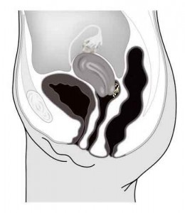 vag.lomme